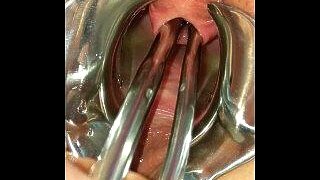Piss Re-injection - Female Urethral Sounding - BDSM Stretched Wide Peehole